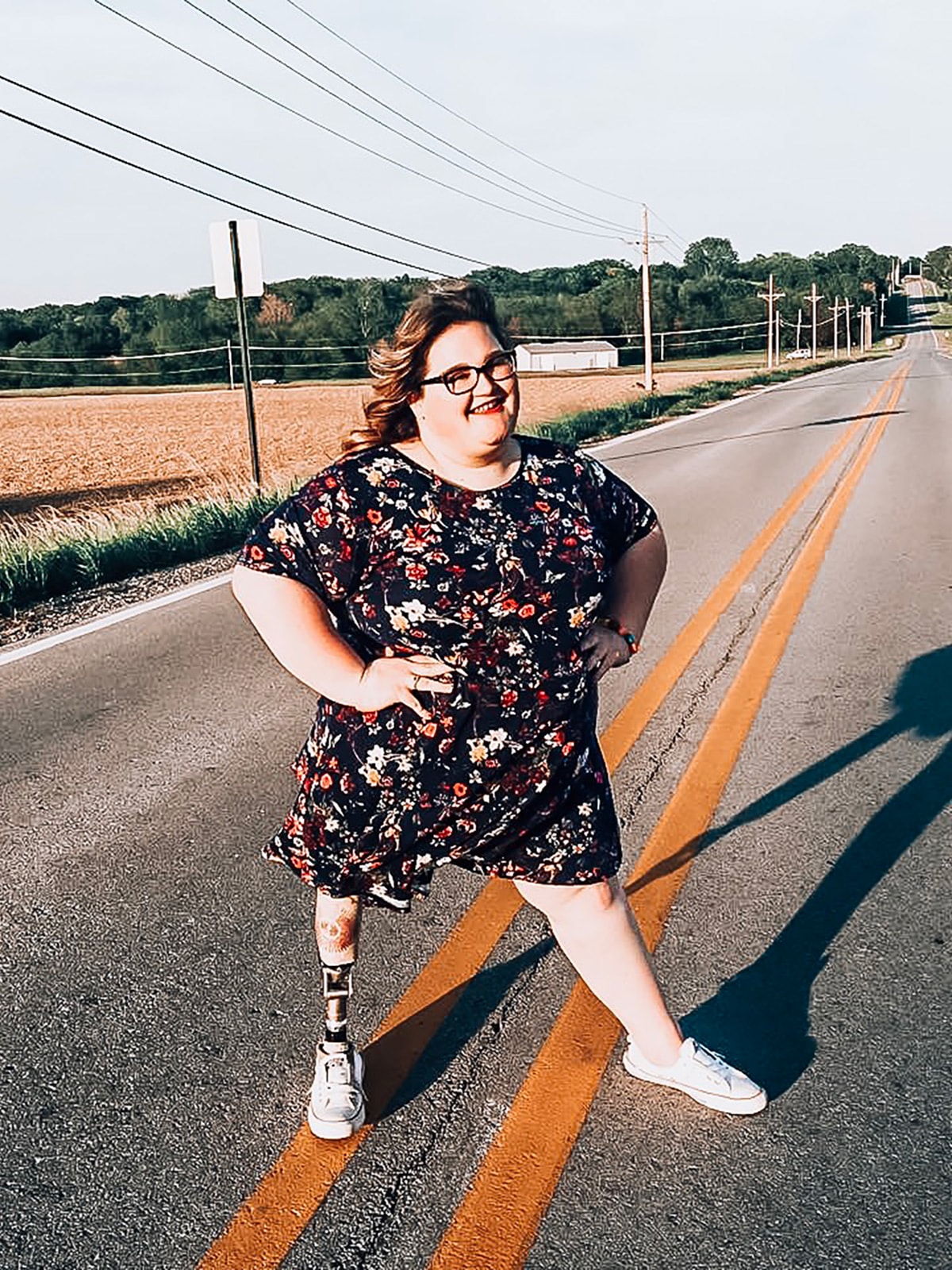 I'm an amputee and I don't need Love is Blind to be more body diverse